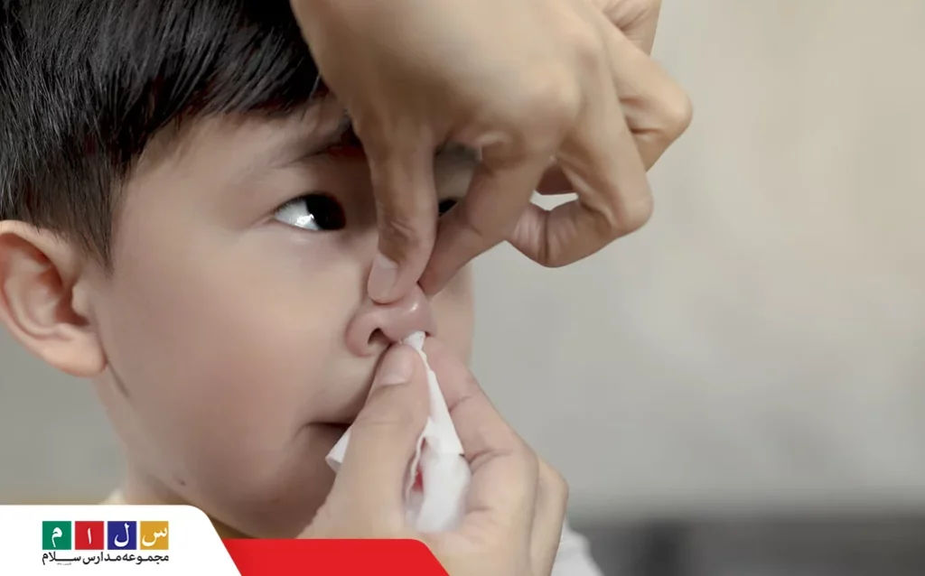 چگونه خونریزی بینی کودک را برطرف کنیم؟